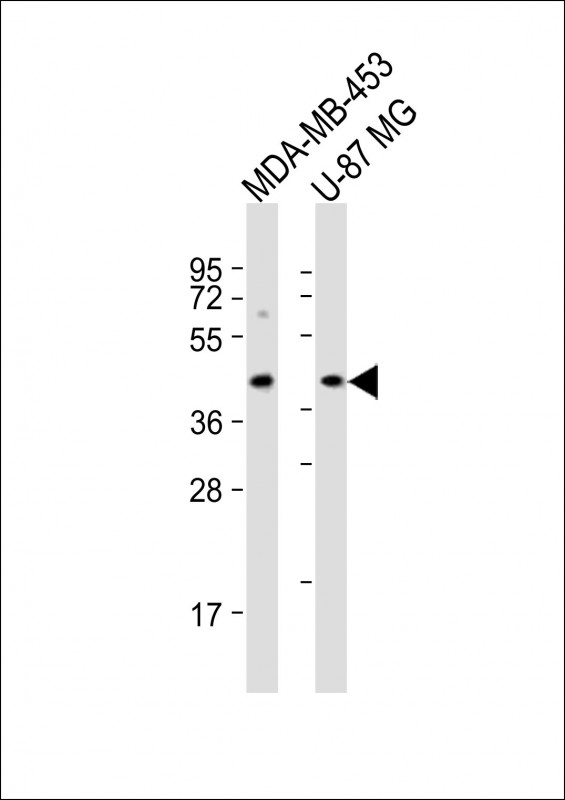 1 - PABPC5 Antibody (C-Term) AP21720b