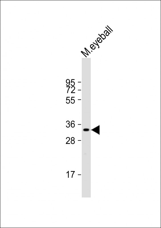 1 - RLBP1 Antibody (C-term) AP21727b
