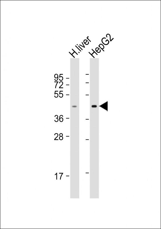 1 - TMPRSS11D Antibody (N-Term) AP21729a