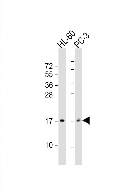 1 - GRP Antibody (Center) AP21751c
