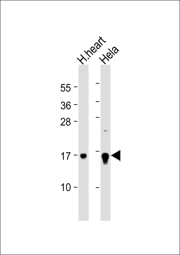1 - CBP20 Antibody AP53309