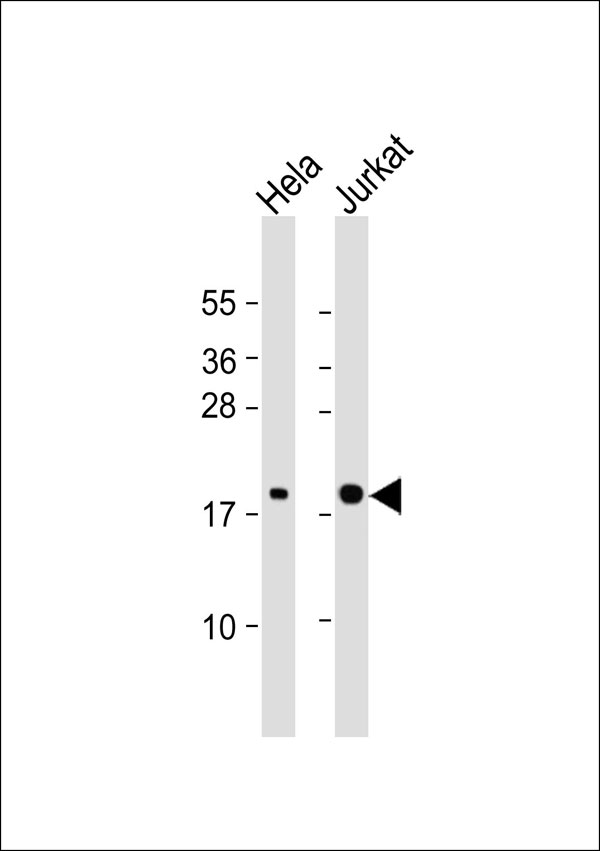 1 - RhoG Antibody AP53317