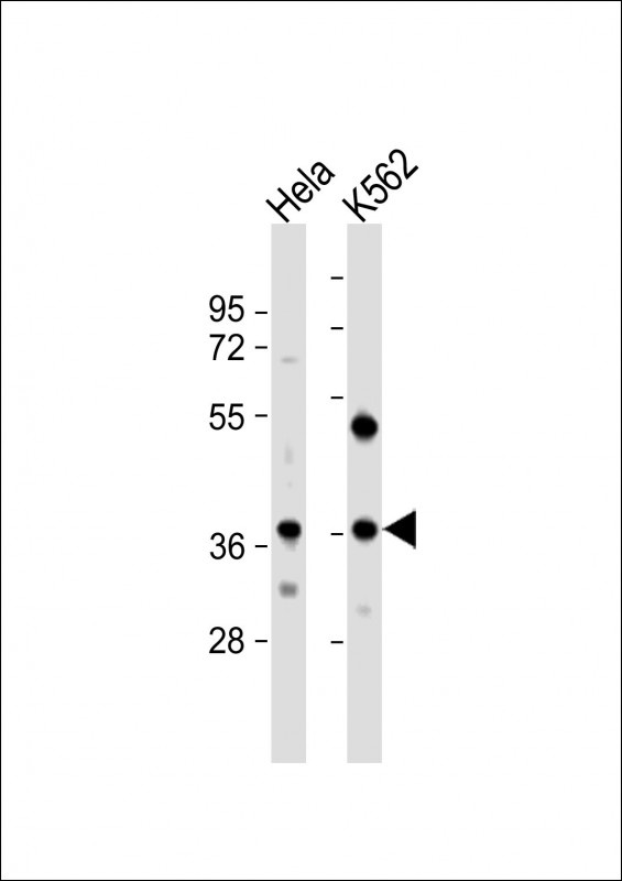 1 - CTDSPL Antibody (N-term) AP10036a