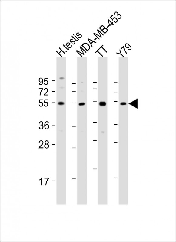 1 - WDR51B Antibody (C-term) AP21756b