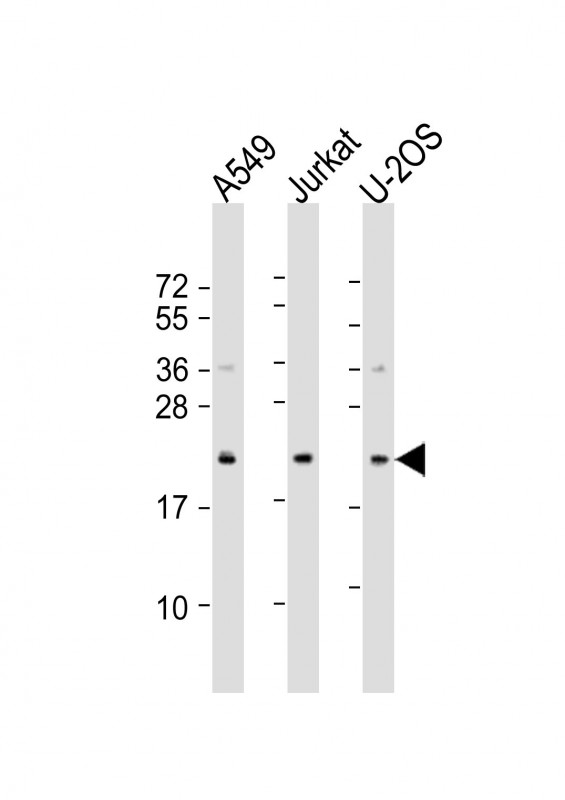 1 - FAAP24 Antibody (N-Term) AP21766a