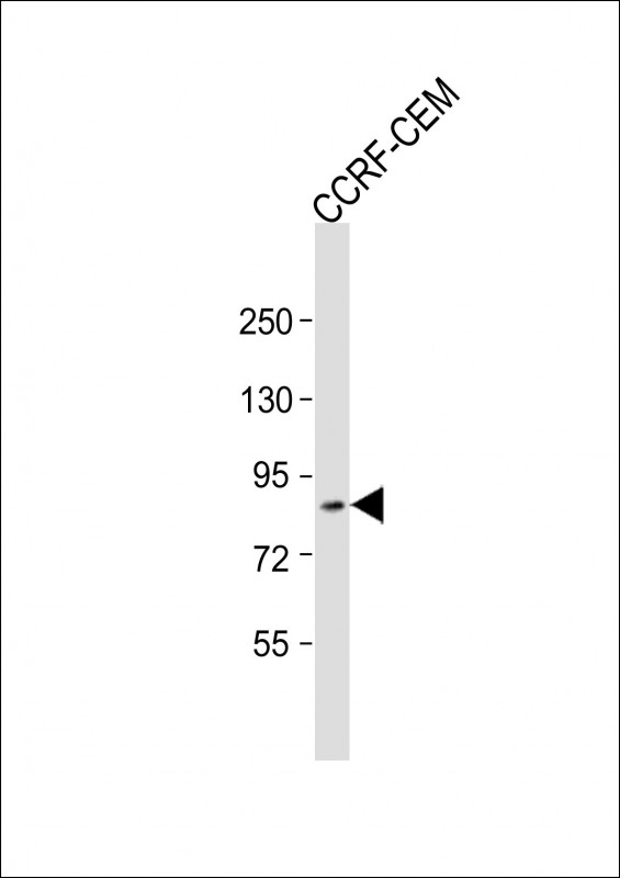 1 - ZKSCAN5 Antibody (N-Term) AP21786a