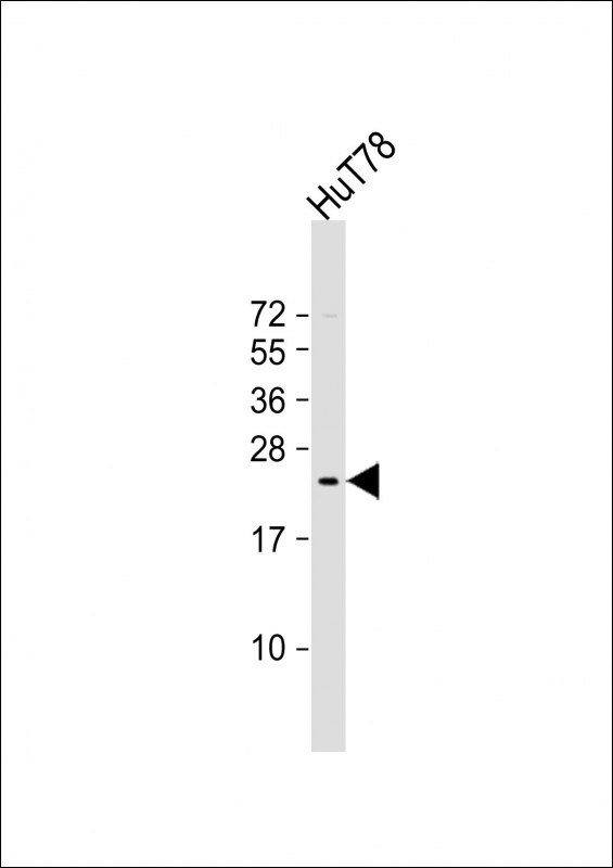 1 - BATF3 Antibody (Center) AP21804c