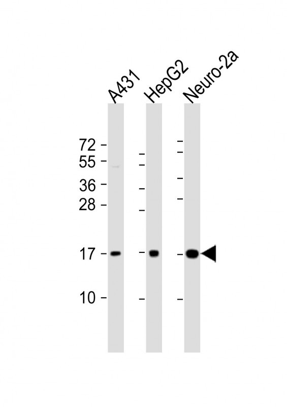 1 - RPL22 Antibody(C-term) AP19858b
