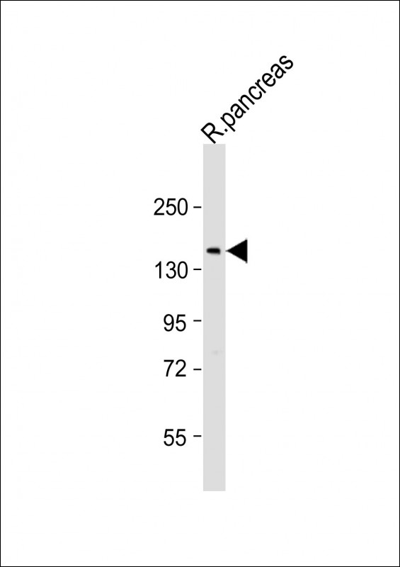 1 - DMBT1 Antibody (C-Term) AP21824b