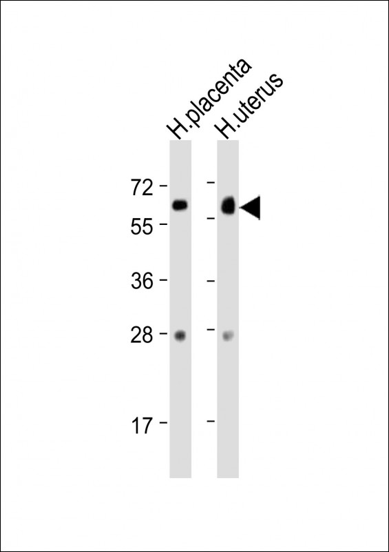 1 - ZBTB7C Antibody (N-Term) AP21825a