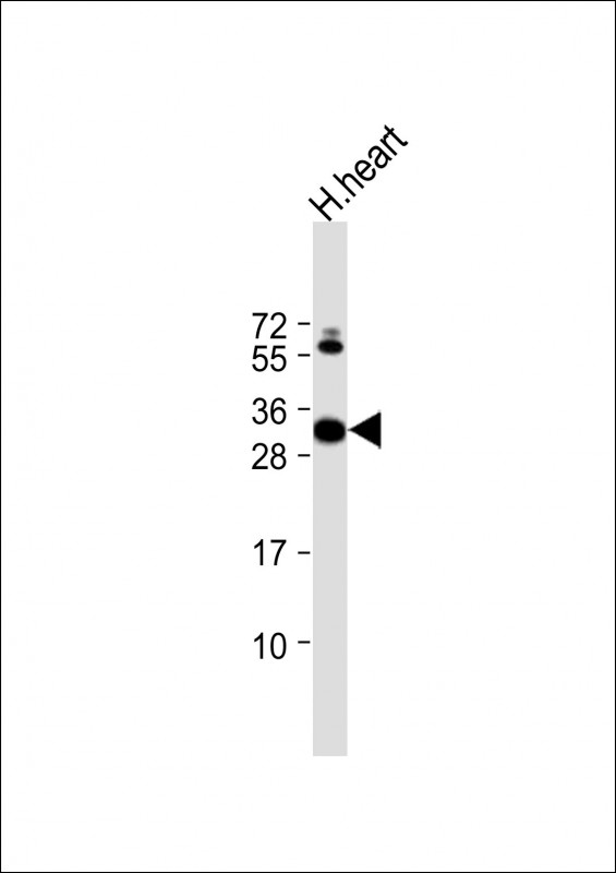1 - CLIC2 Antibody (Center) AP21857c