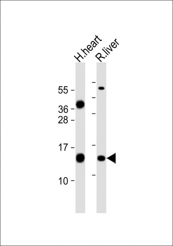 1 - FXC1 Antibody (N-term) AP21868a