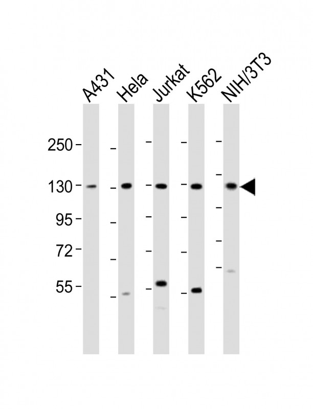 1 - DDX42 Antibody (N-Term) AP21874a