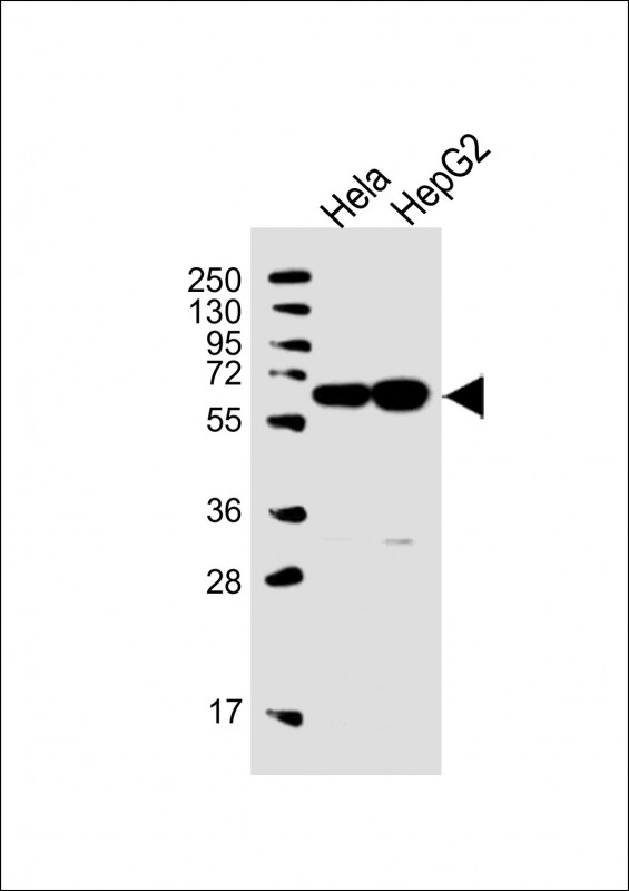 1 - UTP6 Antibody (N-term) AP5296a