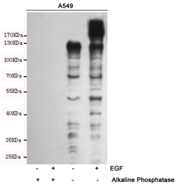 1 - Anti-Phospho-Tyrosine Antibody AP53420