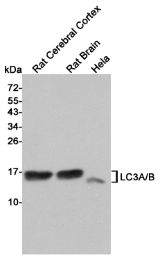 1 - Anti-LC3A/B Antibody AP53484