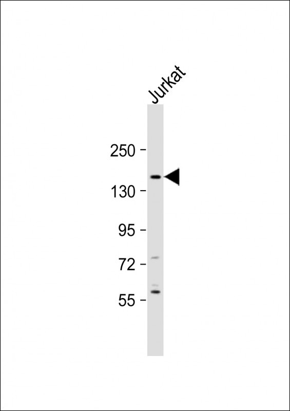1 - GPR124 Antibody (C-Term) AP21894b