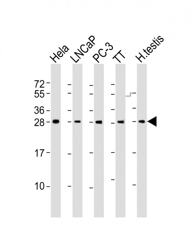 1 - SSX1 Antibody (Center) AP21898c