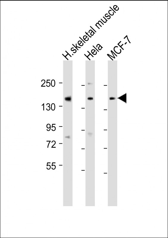 1 - TNRC6A Antibody (Center) AP21900c