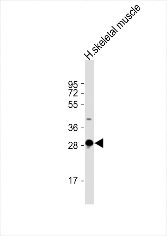 1 - DNASE1L2 Antibody (C-Term) AP21923b