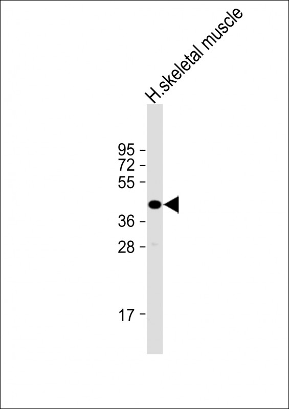1 - TMEM115 Antibody (C-Term) AP21934b