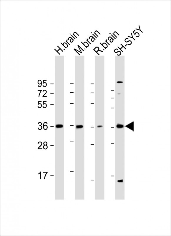 1 - Connexin 36 Antibody (C-term) AP1549b