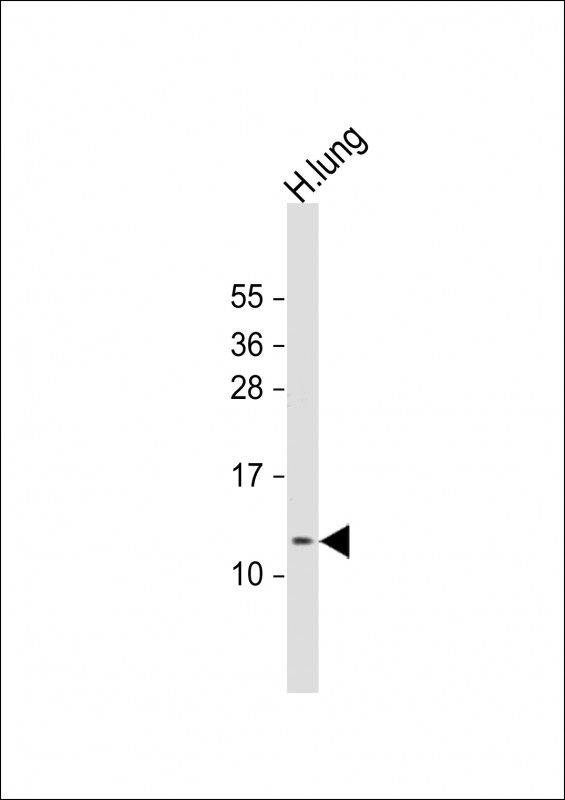 1 - RIG Antibody (C-Term) AP21951b