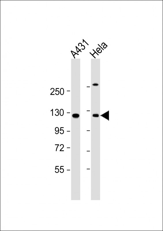 1 - INTS6 Antibody (N-Term) AP21956a
