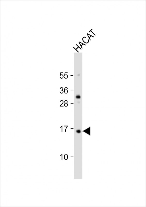 1 - TCTA Antibody (N-Term) AP21962a