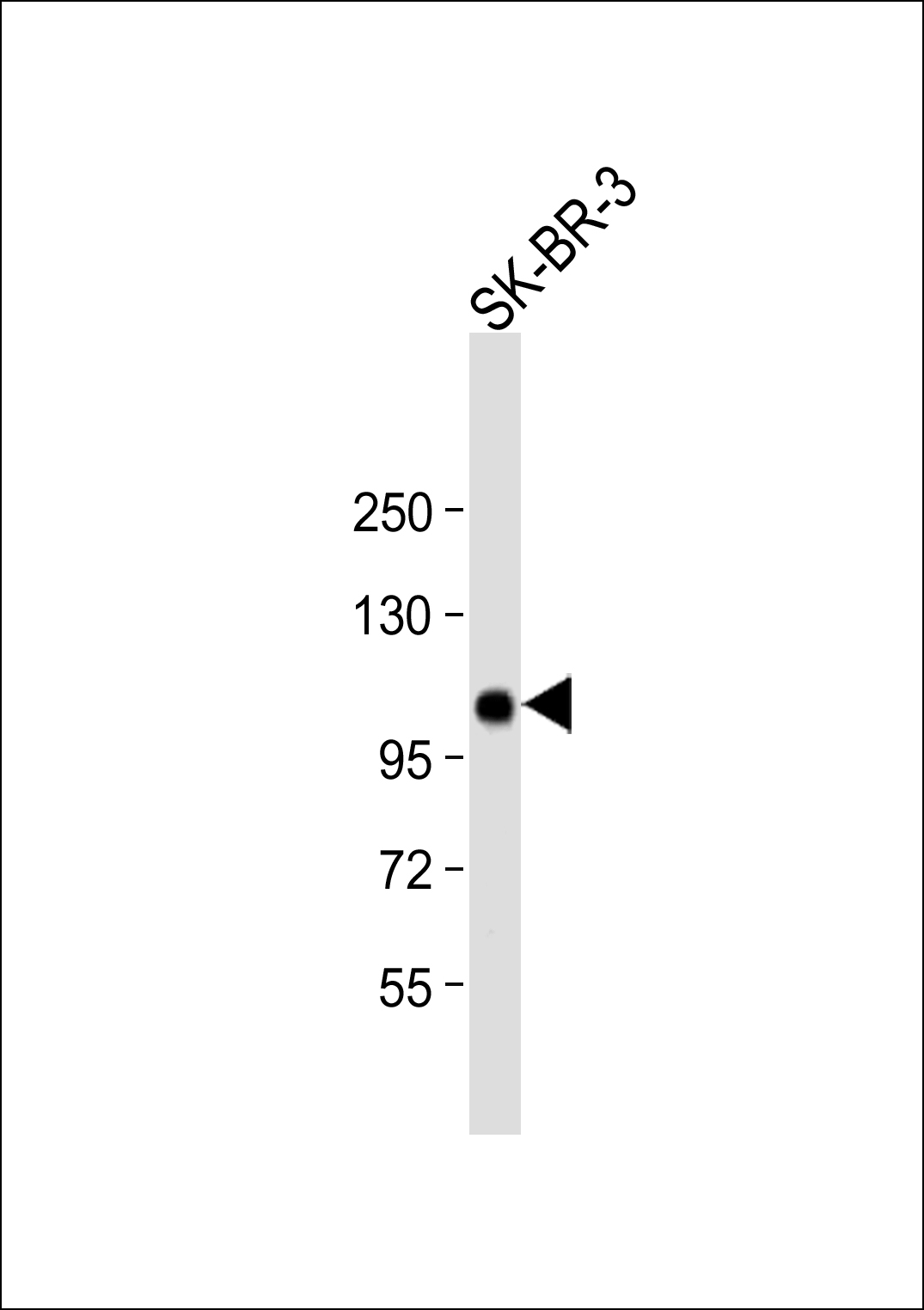 1 - ESPN Antibody (N-term) AP6876a