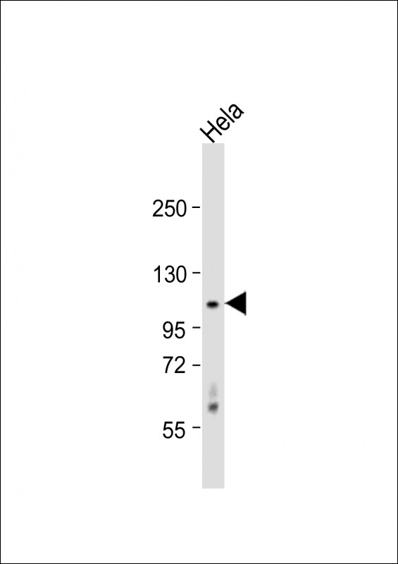 1 - CDKL5 (STK9) Antibody (C-term) AP7244b