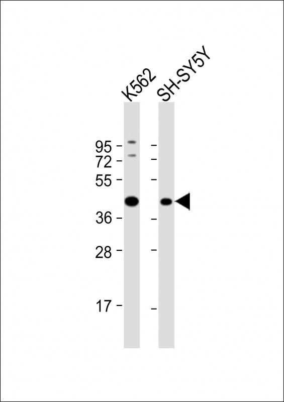 1 - ADH5 Antibody (Center) AP8562C