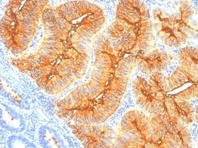 2 -  TAG-72 / CA72.4 (Tumor-Associated Glycoprotein) Antibody - With BSA and Azide AH10426