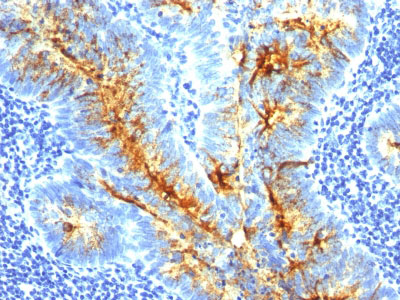 2 -  TAG-72 / CA72.4 (Tumor-Associated Glycoprotein) Antibody - With BSA and Azide AH10429
