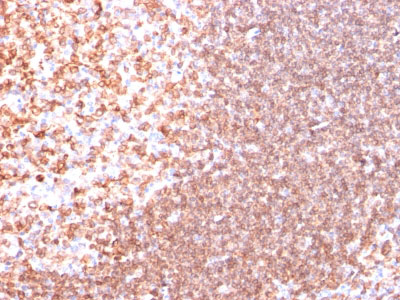 2 -  CD74 (B-Cell Marker) Antibody - With BSA and Azide AH10892