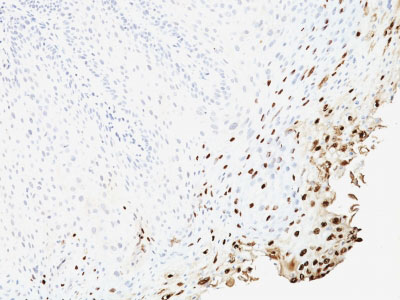 2 -  HPV-16 (Human Papilloma Virus 16) Antibody - With BSA and Azide AH10939