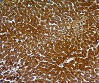 2 -  Hepatocyte Specific Antigen (Hepatocellular Marker) Antibody - With BSA and Azide AH10943
