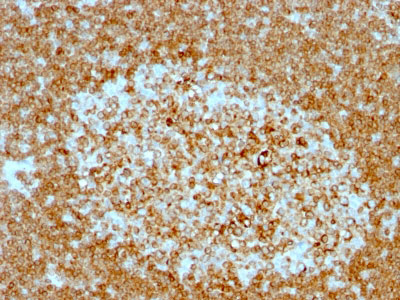 2 -  CD74 (B-Cell Marker) Antibody - With BSA and Azide AH12812