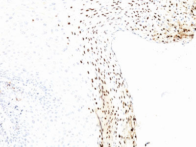 2 -  HPV-16 (Human Papilloma Virus 16) Antibody - With BSA and Azide AH12872