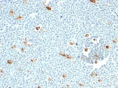 2 -  Macrophage, pan (Histiocytoma & Sebocyte Marker) Antibody - With BSA and Azide AH12879