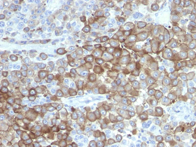 2 -  PNL2 (Melanoma Associated Antigen) Antibody - With BSA and Azide AH12892