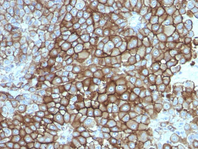 2 -  KBA.62 (Melanoma Associated Antigen) Antibody - With BSA and Azide AH12895