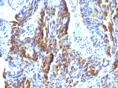 2 -  KBA.62 (Melanoma Associated Antigen) Antibody - With BSA and Azide AH12895