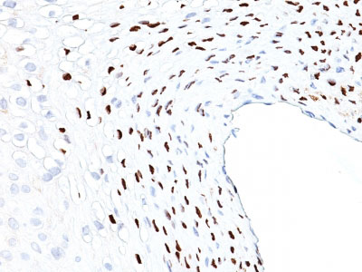 2 -  HPV-16 (Human Papilloma Virus 16) Antibody - With BSA and Azide AH12960