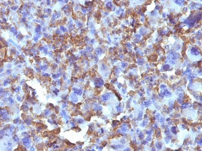 2 -  Macrophage & Histiocytoma Marker Antibody - With BSA and Azide AH12974