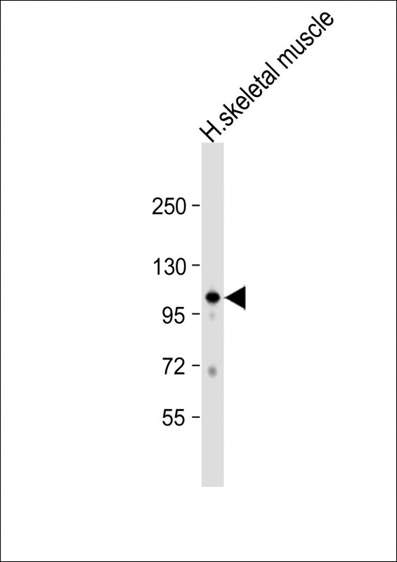 1 - GAS2L2 Antibody (C-term) AP11417b