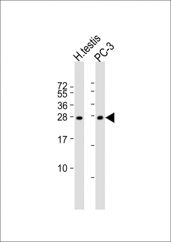 1 - IL25 Antibody (Center) AP14661c
