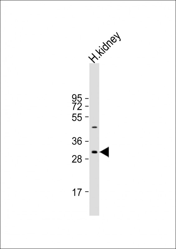 1 - NRIP2 Antibody (Center) AP17224C