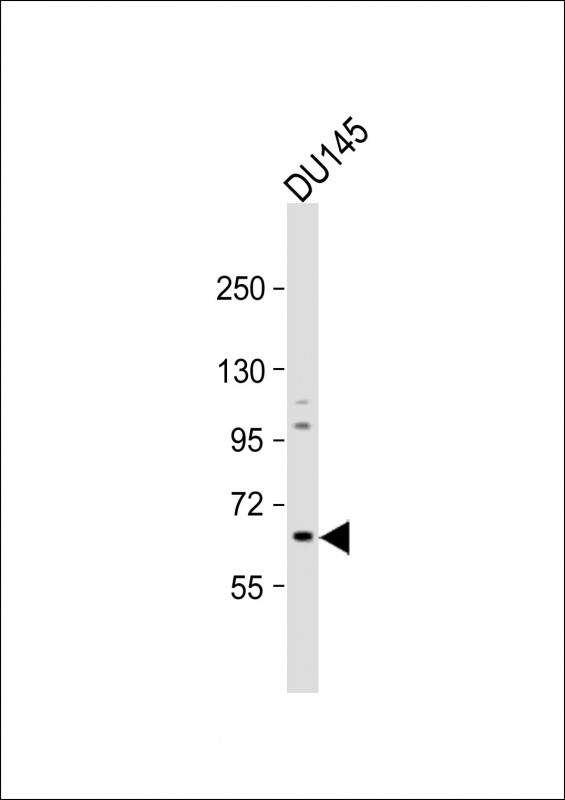 1 - GALNT9 Antibody (Center) AP17972c