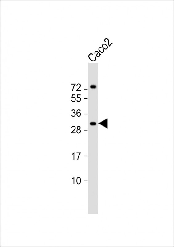 1 - RASL12 Antibody (C-term) AP18108b